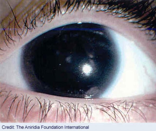 Juan Antonio Leonís